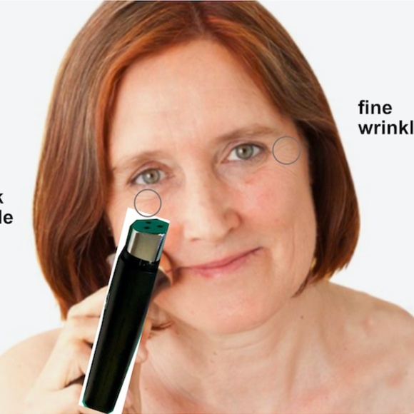 Eye Wrinkle Removal LED Pen - Picture 6 of 7